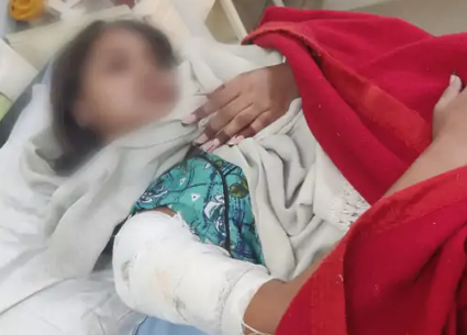 युवती के दाहिने कंधे और हाथ में गोली लगी है।